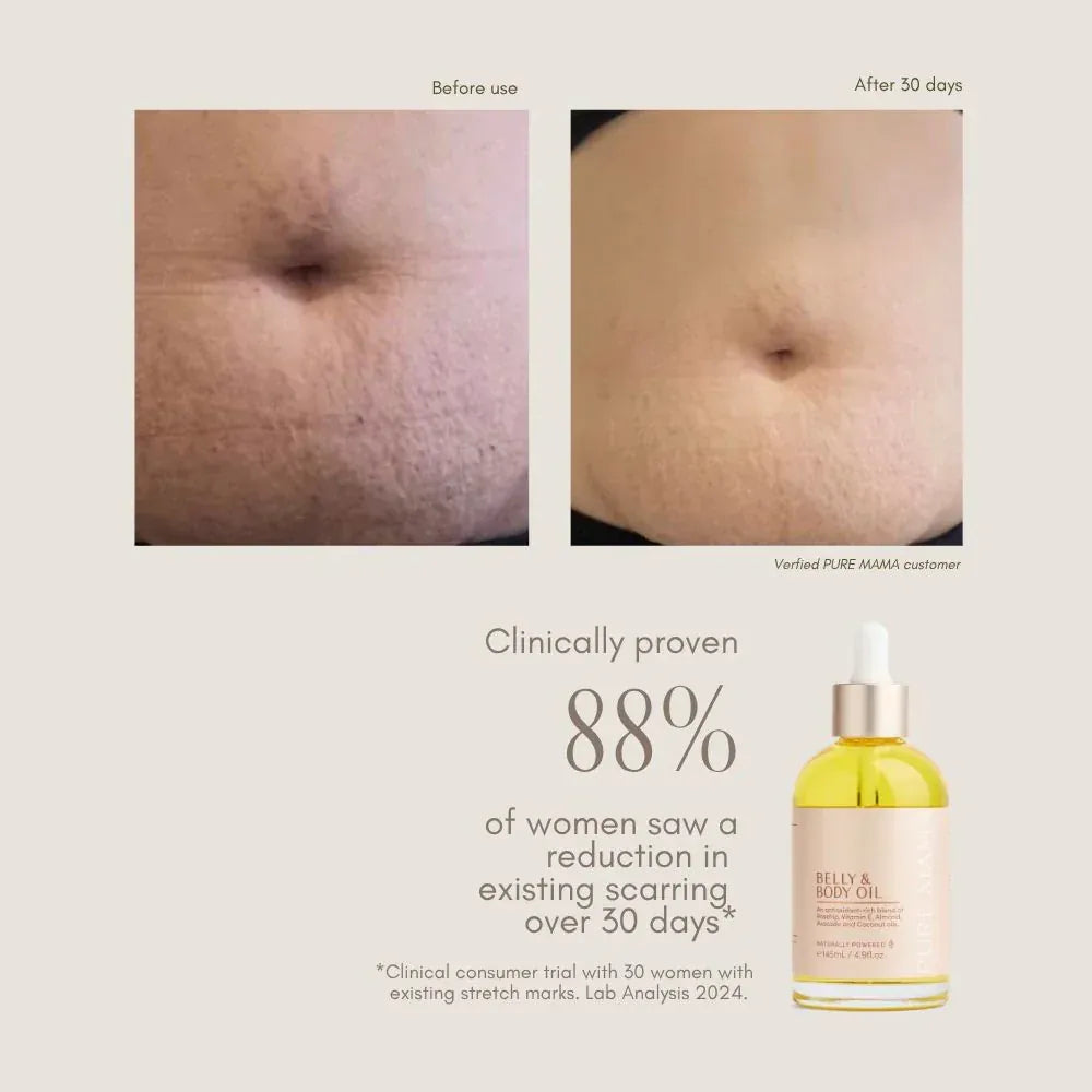 Belly & Body Oil - Parnell Baby Boutique