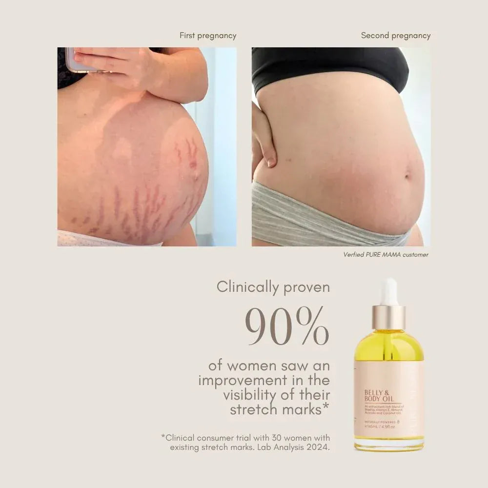 Belly & Body Oil - Parnell Baby Boutique