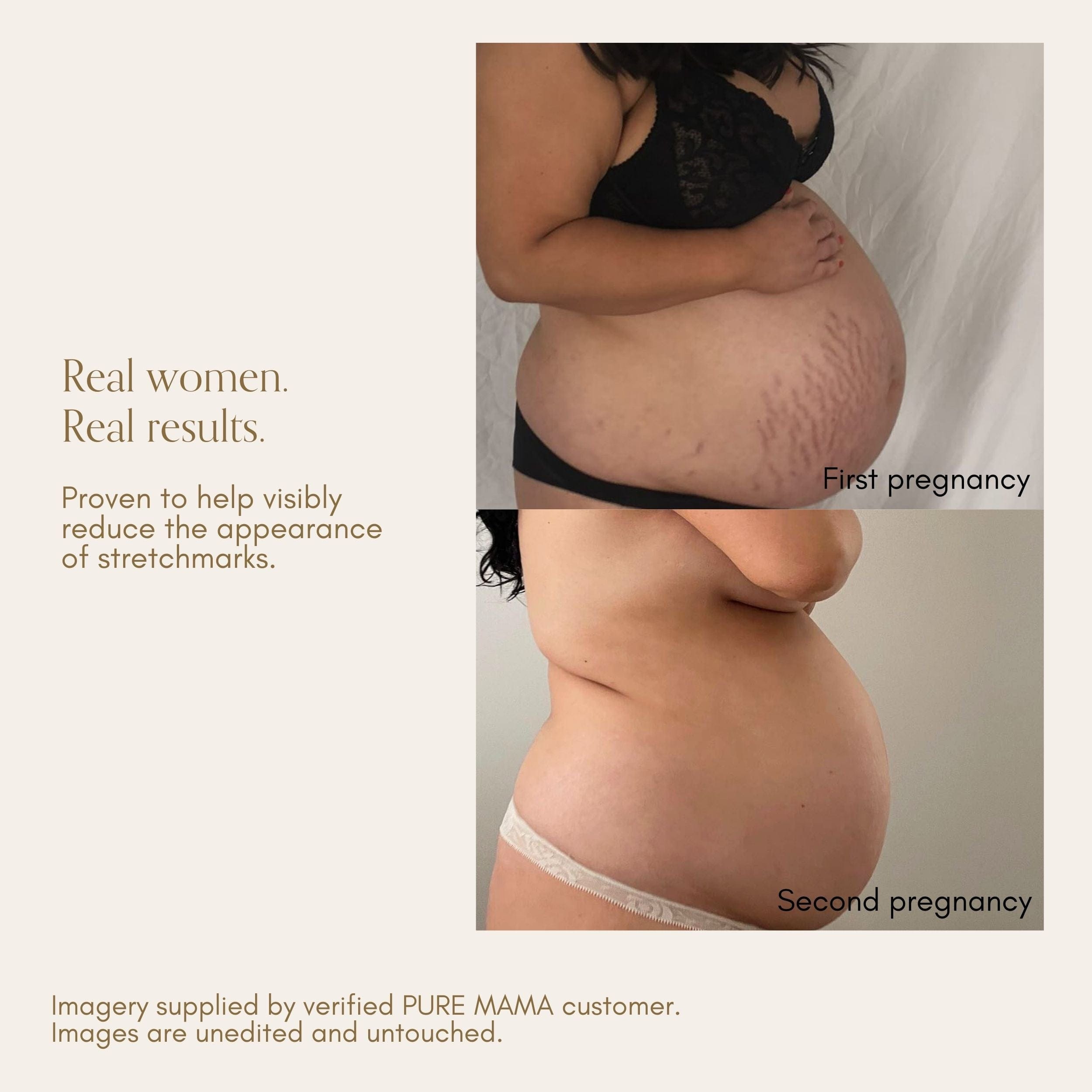 Pure Mama For Mum Bump Love Set