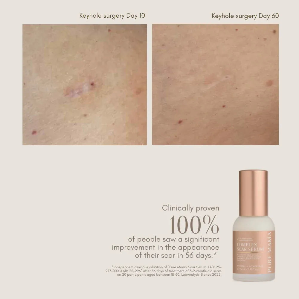Pure Mama For Mum Complex Scar Serum - 35ml
