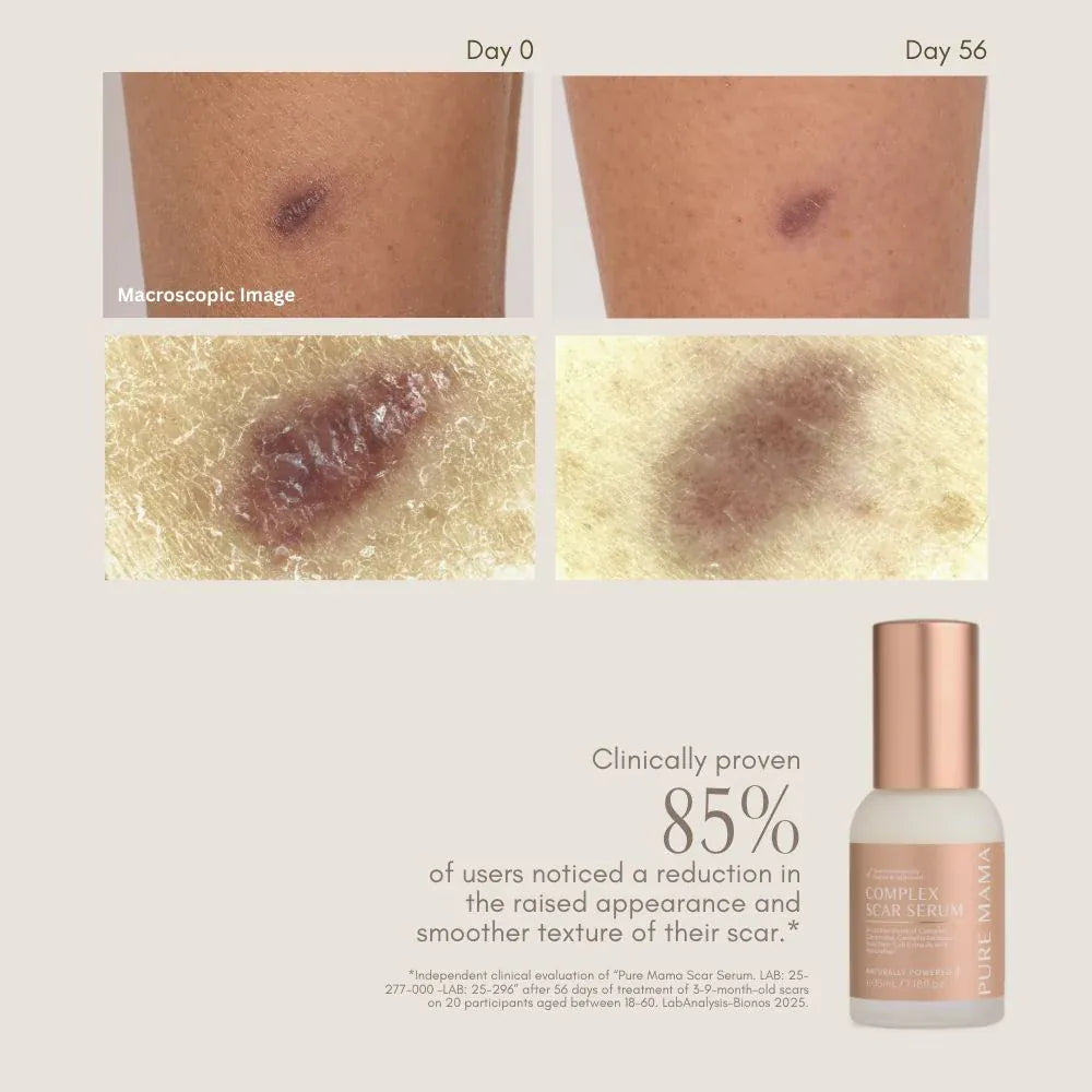 Pure Mama For Mum Complex Scar Serum - 35ml
