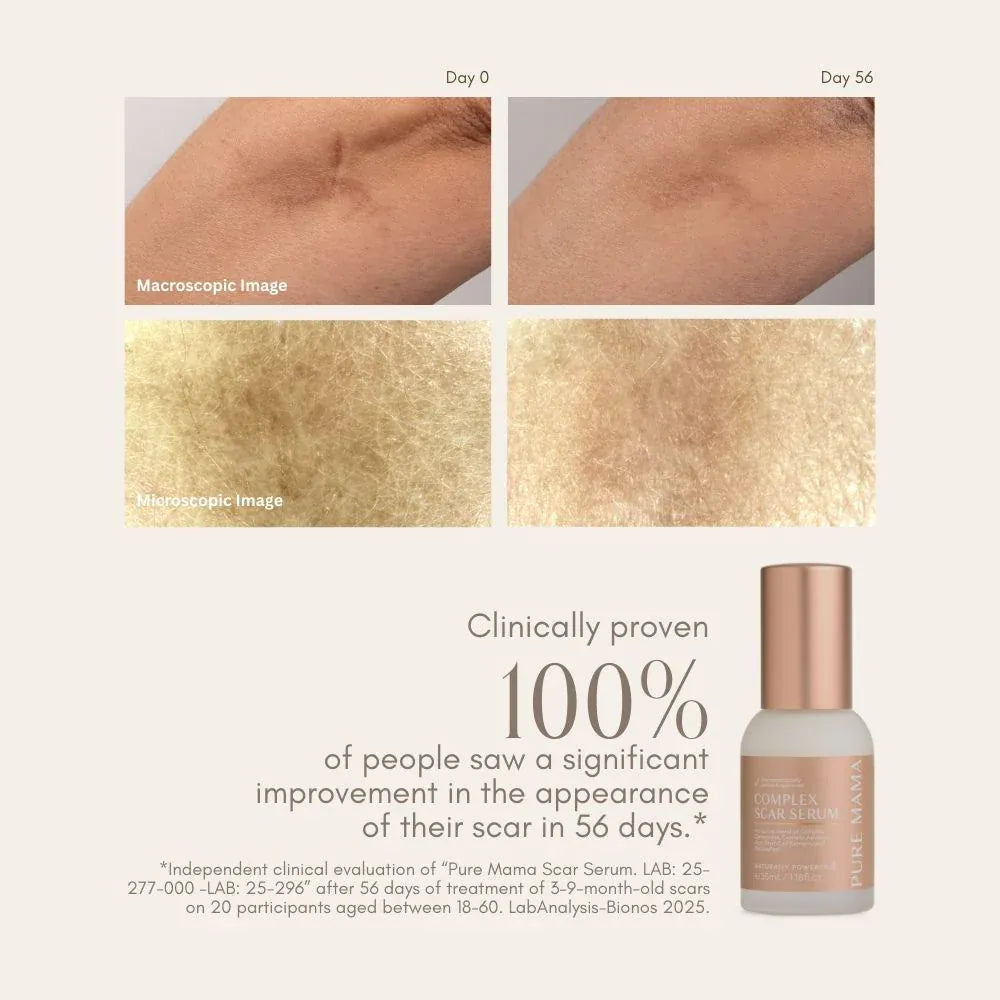 Pure Mama For Mum Complex Scar Serum - 35ml