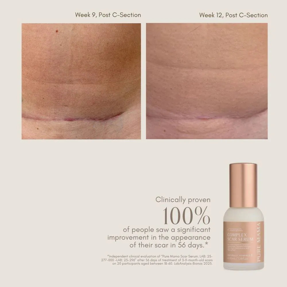 Pure Mama For Mum Complex Scar Serum - 35ml