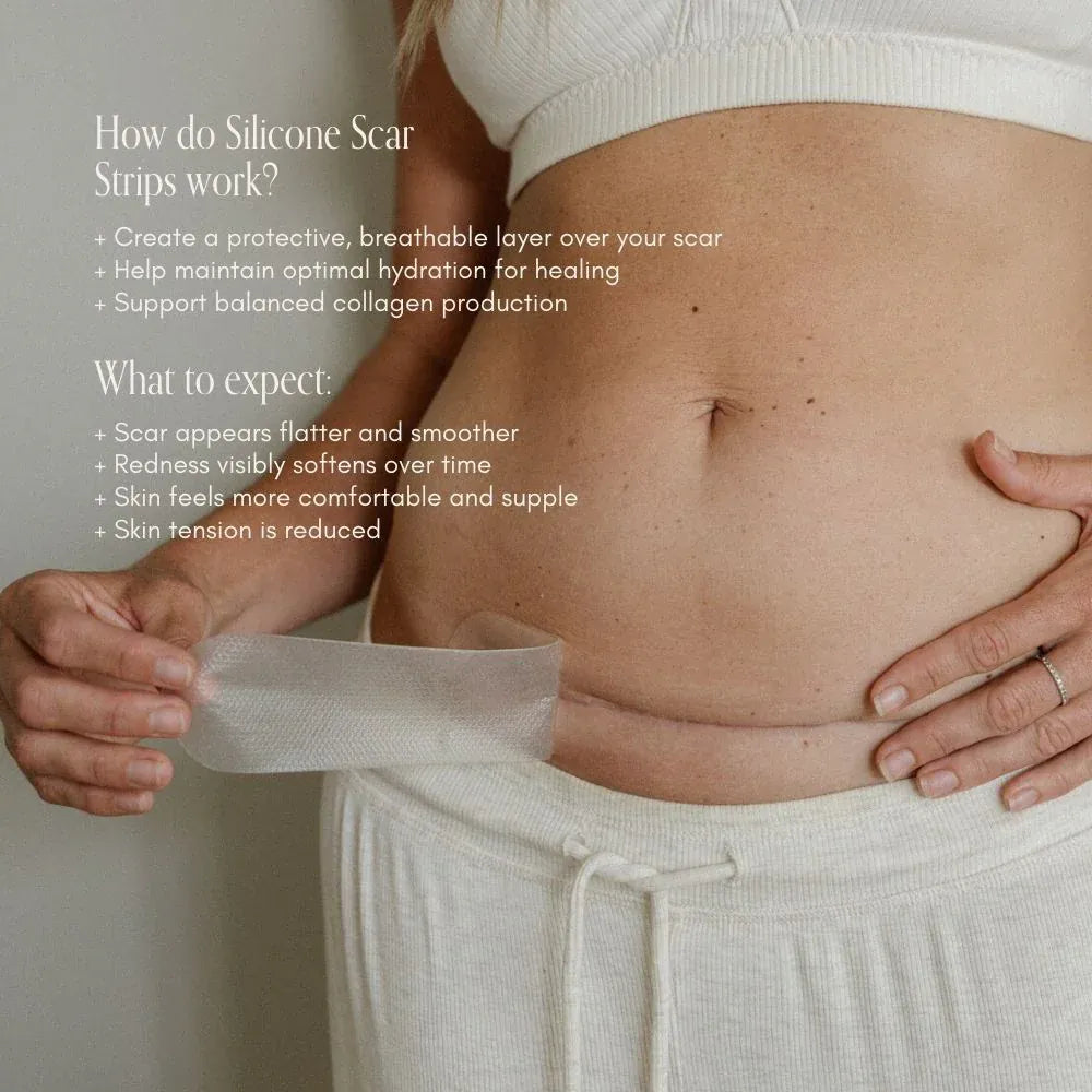 Pure Mama For Mum Silicone Scar Strip